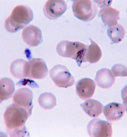 Psalmodium